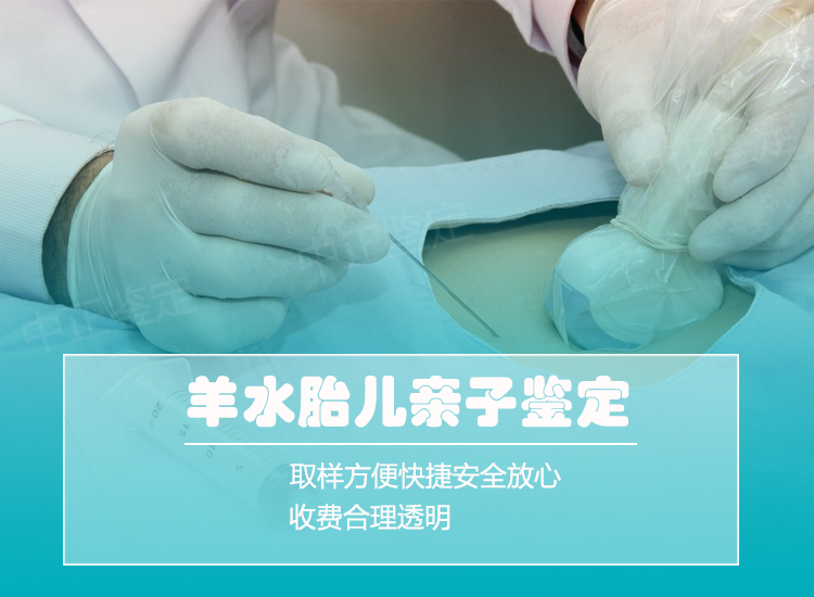 德阳羊水孕期亲子鉴定